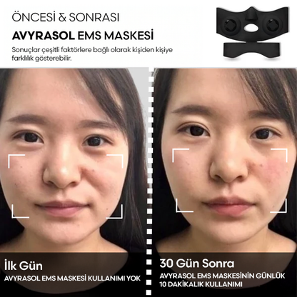 Avyrasol EMS Maske