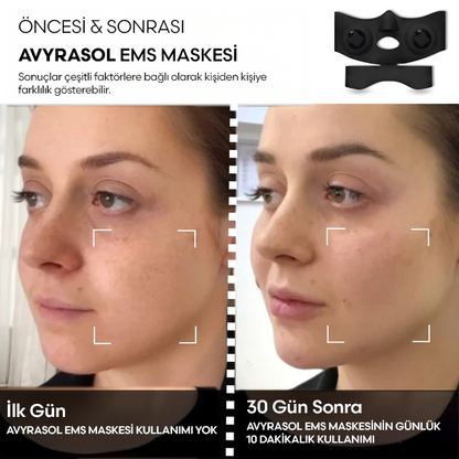 Avyrasol EMS Maske